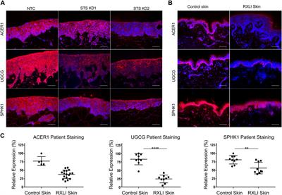 RNA sequencing and lipidomics uncovers novel pathomechanisms in recessive X-linked ichthyosis